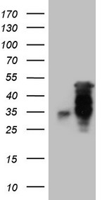 SNRPB2 Antibody