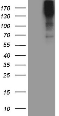 SNRPB2 Antibody