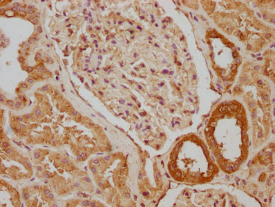 SNX5 Antibody