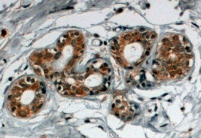 SNX5 Antibody