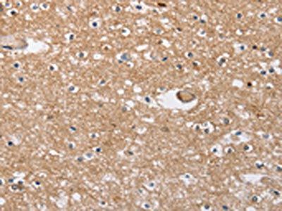 SOCS2 Antibody