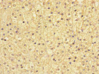 SOCS5 Antibody
