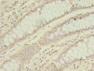 SOD2 Antibody