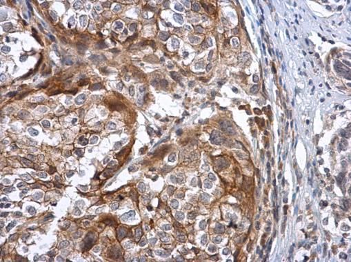 Sodium/Potassium ATPase beta 3 Rabbit Polyclonal Antibody