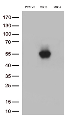 Somatostatin Receptor 5 Antibody