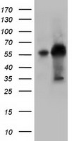 Sorbitol Dehydrogenase Antibody