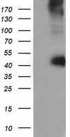 Sorbitol Dehydrogenase Antibody