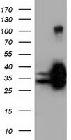 Sorbitol Dehydrogenase Antibody