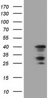 Sorbitol Dehydrogenase Antibody