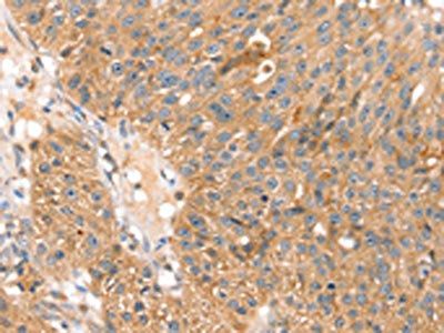 SOX11 Antibody