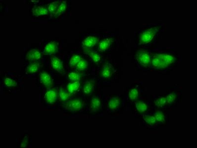 SOX21 Antibody