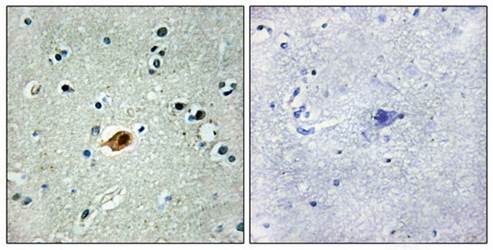 SOX8/9/17/18 Antibody