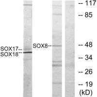 SOX8/SOX9/SOX17/SOX18 Antibody