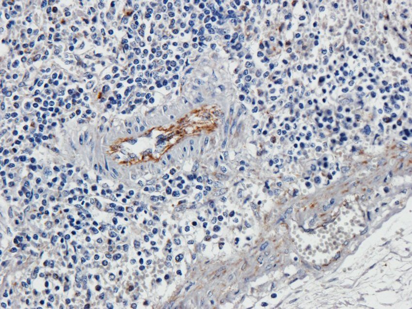 SOX9 antibody