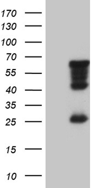 SP110 Antibody