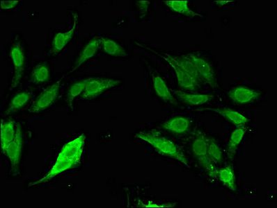SP110 Antibody