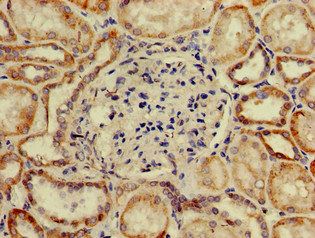 SP110 Antibody