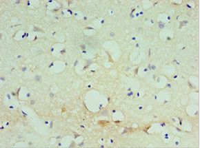 SPAG16 Antibody