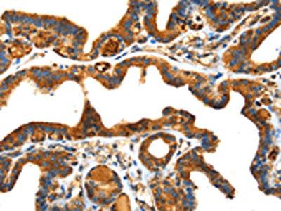 SPARC Antibody