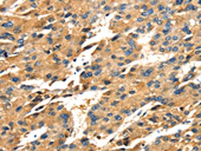 SPARC Antibody