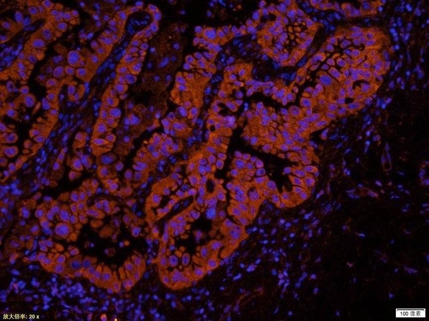 SPC18 antibody