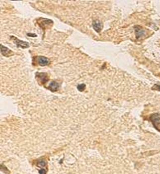 ZFYVE27 Rabbit Polyclonal Antibody