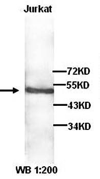 ZFYVE27 Rabbit Polyclonal Antibody