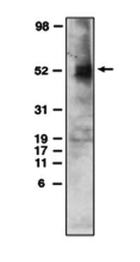 Mouse Human Sphingosine 1 Phosphate 4 Receptor (CT) (EDG6) Antibody