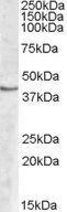 SPHK1 Antibody