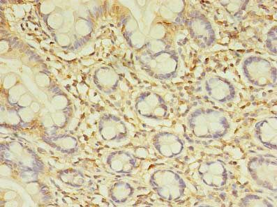 SPIC Antibody