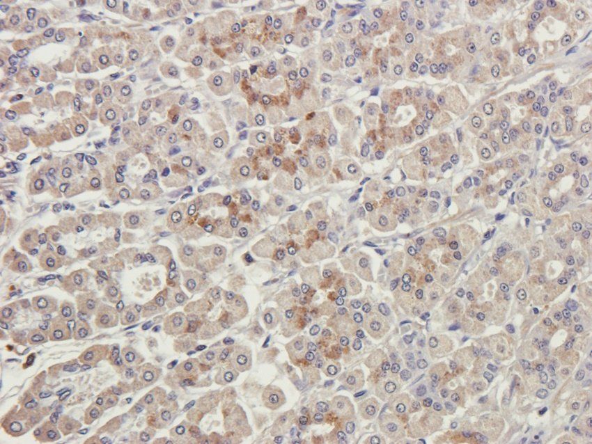 SPIN Rabbit Polyclonal Antibody