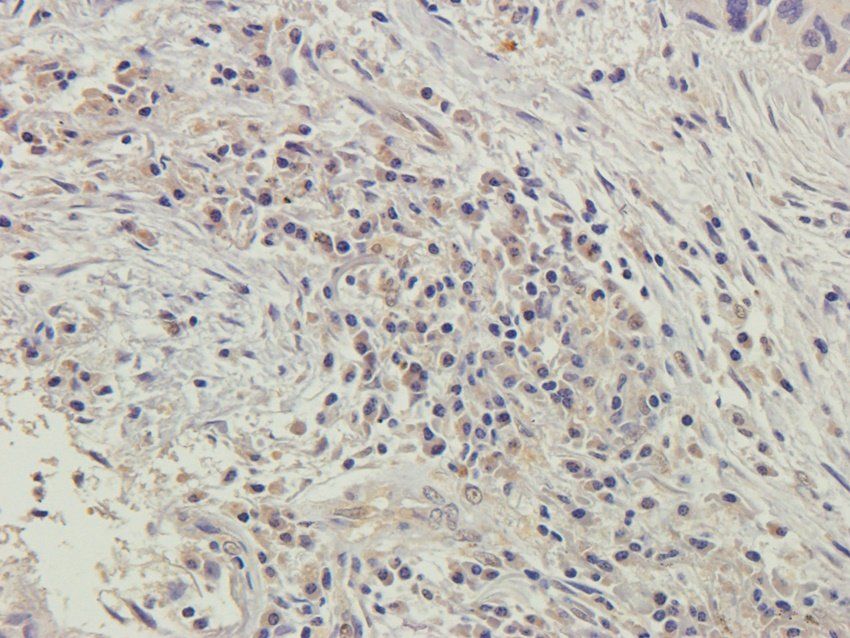 SPIN Rabbit Polyclonal Antibody