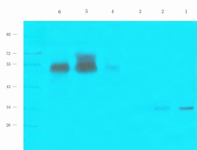 SPIN Rabbit Polyclonal Antibody
