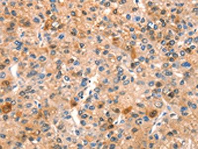 SPRN Antibody