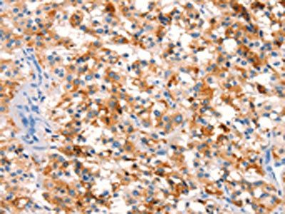 SPRN Antibody