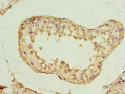 SPRTN Antibody