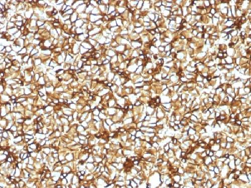 SPTBN2 Antibody