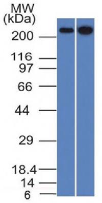 SPTBN2 Antibody
