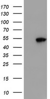 SQSTM1 Antibody
