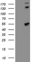 SQSTM1 Antibody