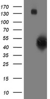 SQSTM1 Antibody