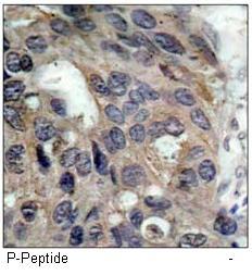 Src (Phospho-Tyr529) Antibody