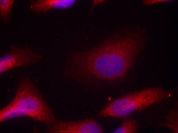 Src (Phospho-Tyr529) Antibody