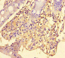 SRGAP2C Antibody