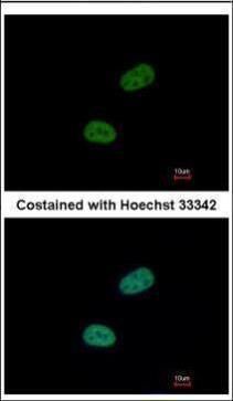 sushi repeat containing protein X-linked Antibody