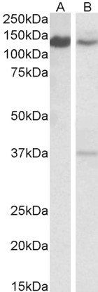 SRRT/ARS2 Antibody