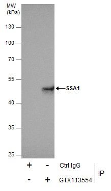 tripartite motif containing 21 Antibody