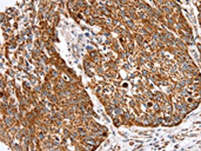 SSBP1 Antibody