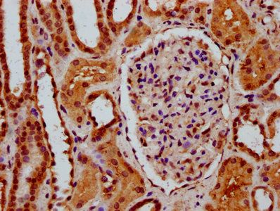 SSBP3 Antibody