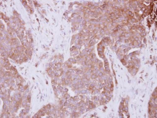 signal transducing adaptor molecule Antibody